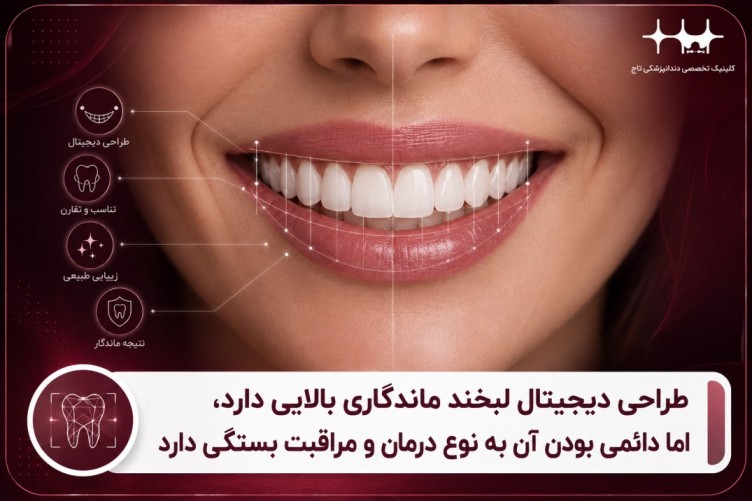 آیا طراحی دیجیتال لبخند دائمی است