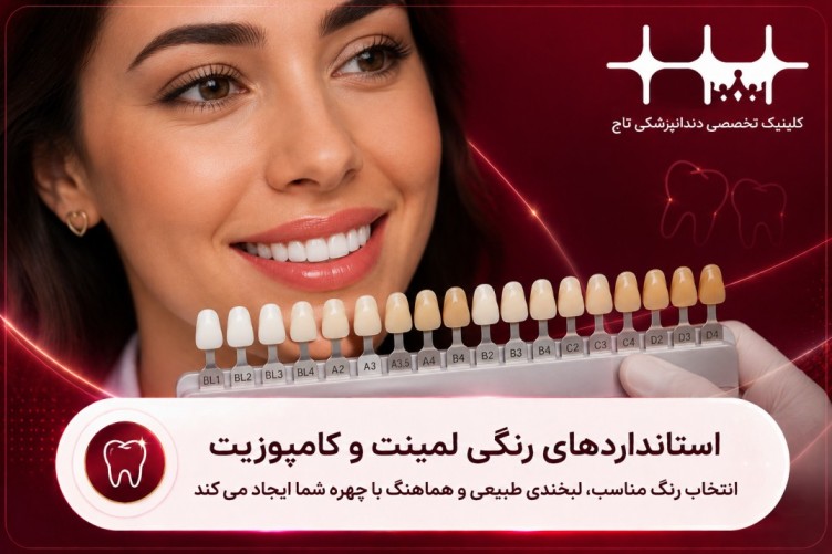 استانداردهای رنگی لمینت و کامپوزیت