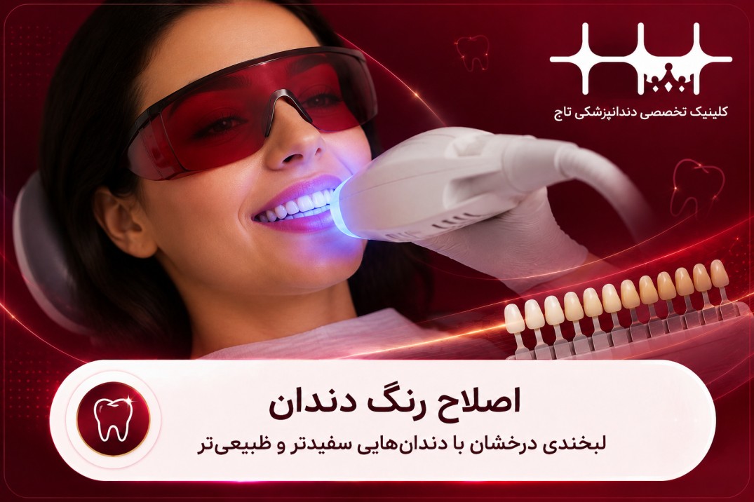 اصلاح رنگ دندان