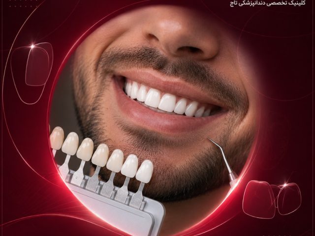 اصلاح فرم و رنگ دندان