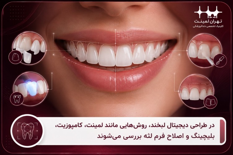 انواع روش‌های درمانی در طراحی دیجیتال لبخند