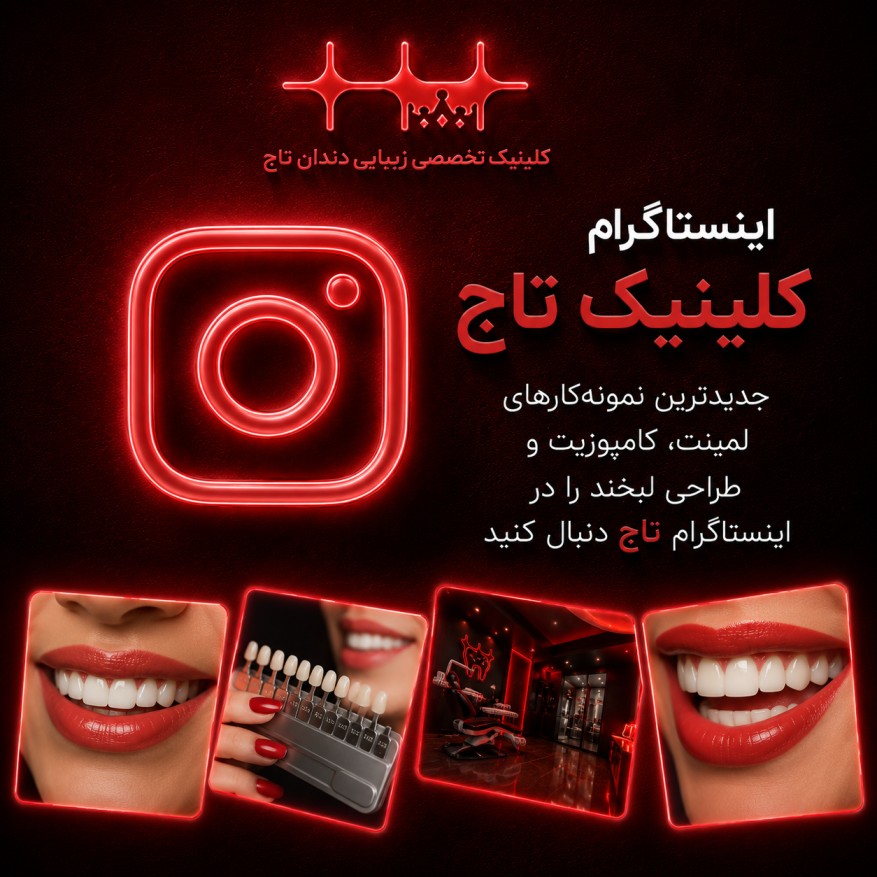 نمونه‌کار اینستاگرام کلینیک تاج 1