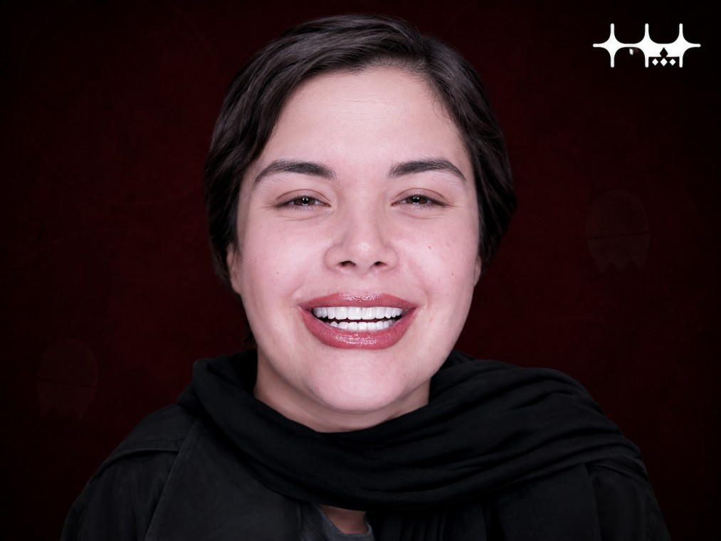 بعد
