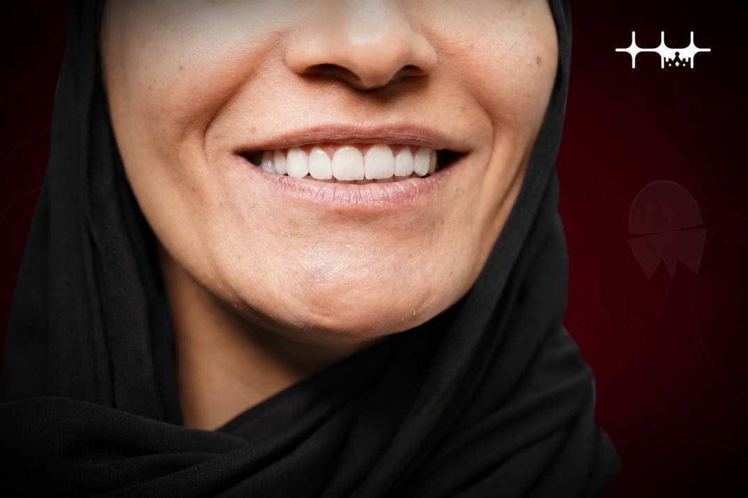 بعد