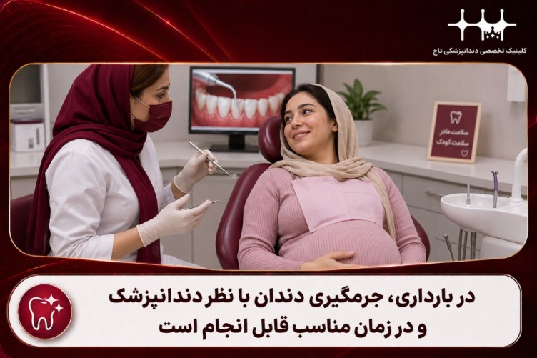 جرمگیری دندان در بارداری