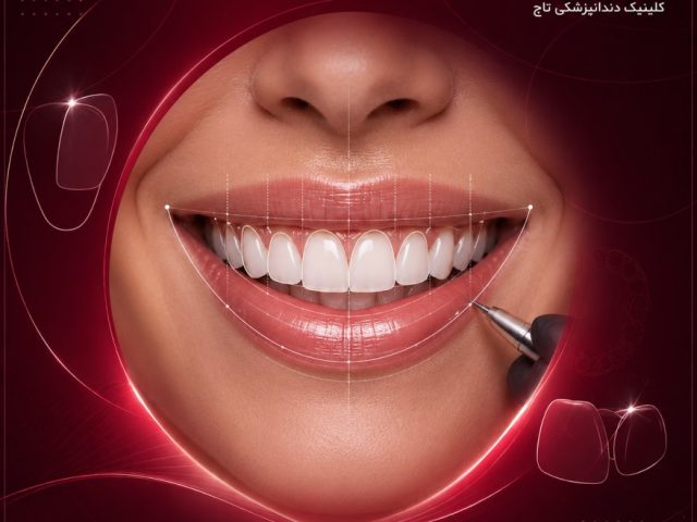 طراحی دیجیتال لبخند