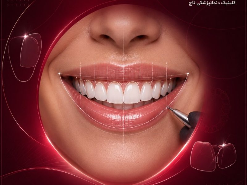 طراحی دیجیتال لبخند