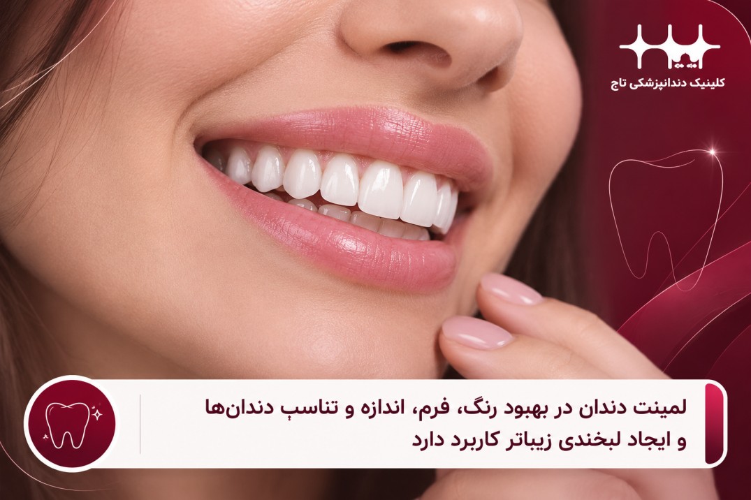 لیمنت چه مزایایی دارد