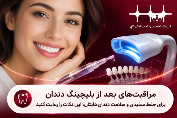 مراقبت‌های بعد از بلیچینگ دندان