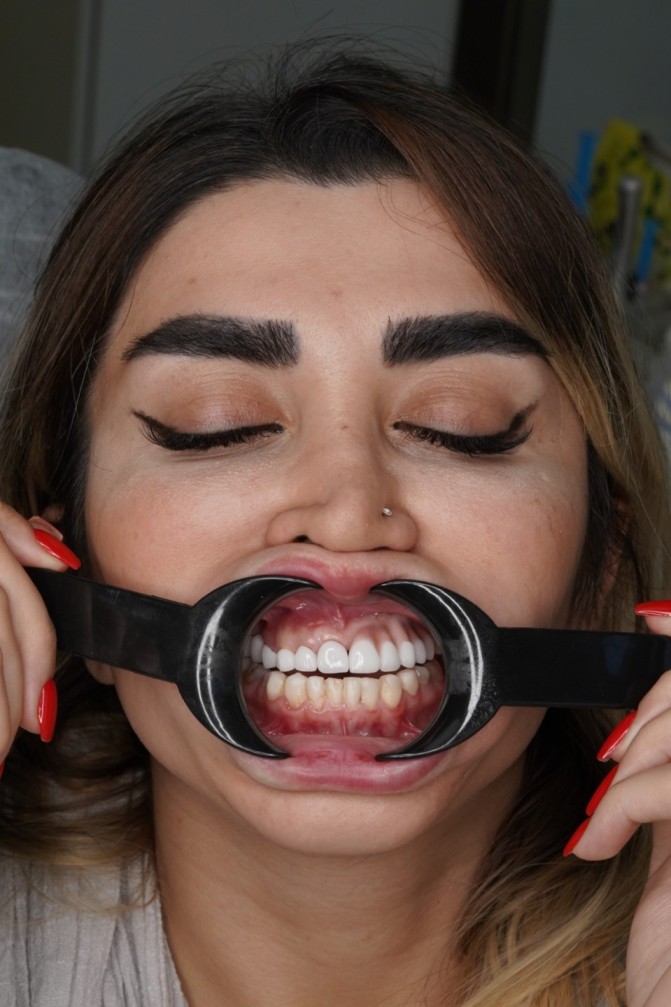 قبل