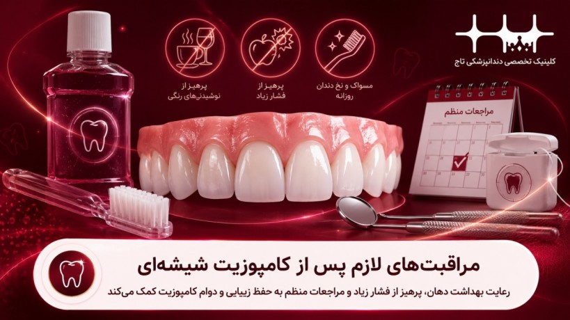 مراقبتهای بعد از کامپوزیت شیشهای دندان